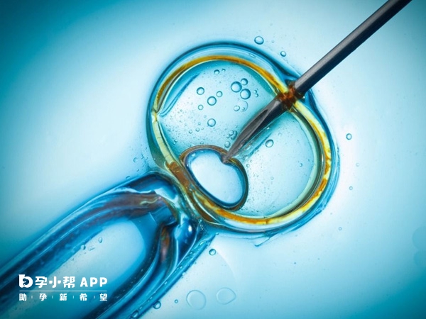 南京中大医院采用无痛取卵技术