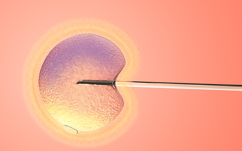 單精子注射費需要4000元左右