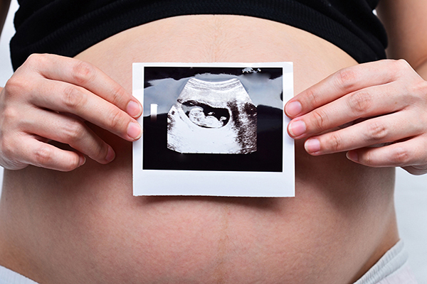 八个月怀女孩肚型图片
