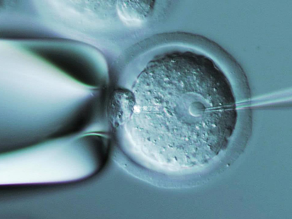 试管婴儿无痛移植胚胎
