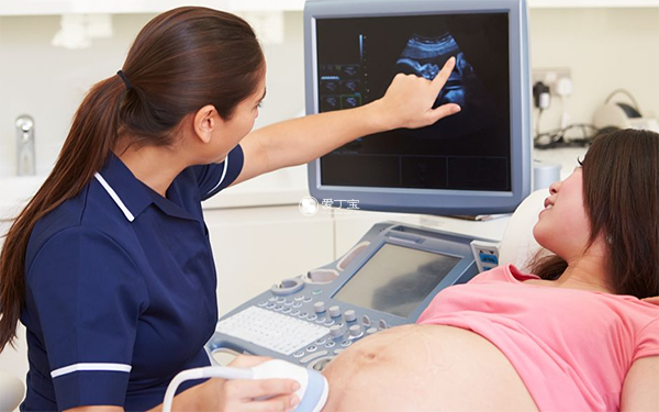 怀孕37周和38周都需要做B超检查