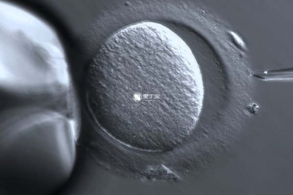 供精人工授精需要监测女性排卵
