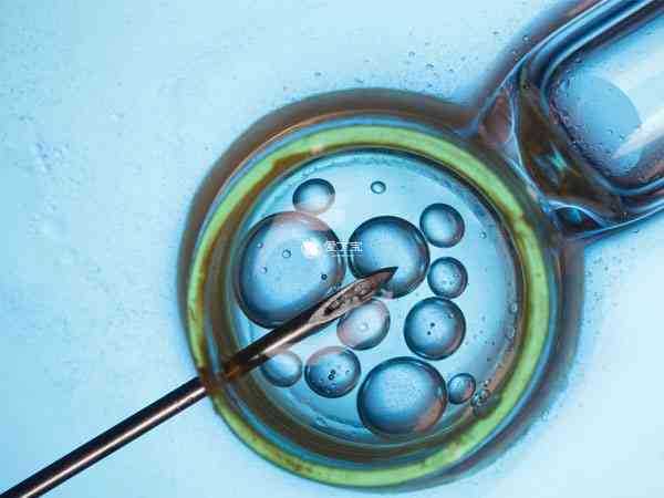 胚胎质量影响试管婴儿成功率